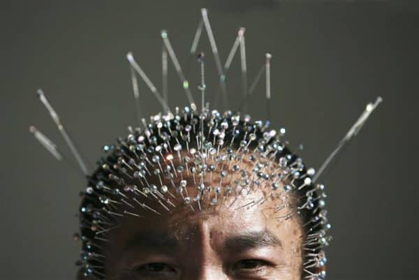 Acupunctura cea mai cunoascută terapie tradiţională chineză