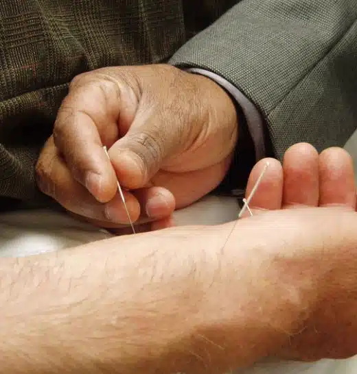 Alternativele naşterii fără dureri acupunctura