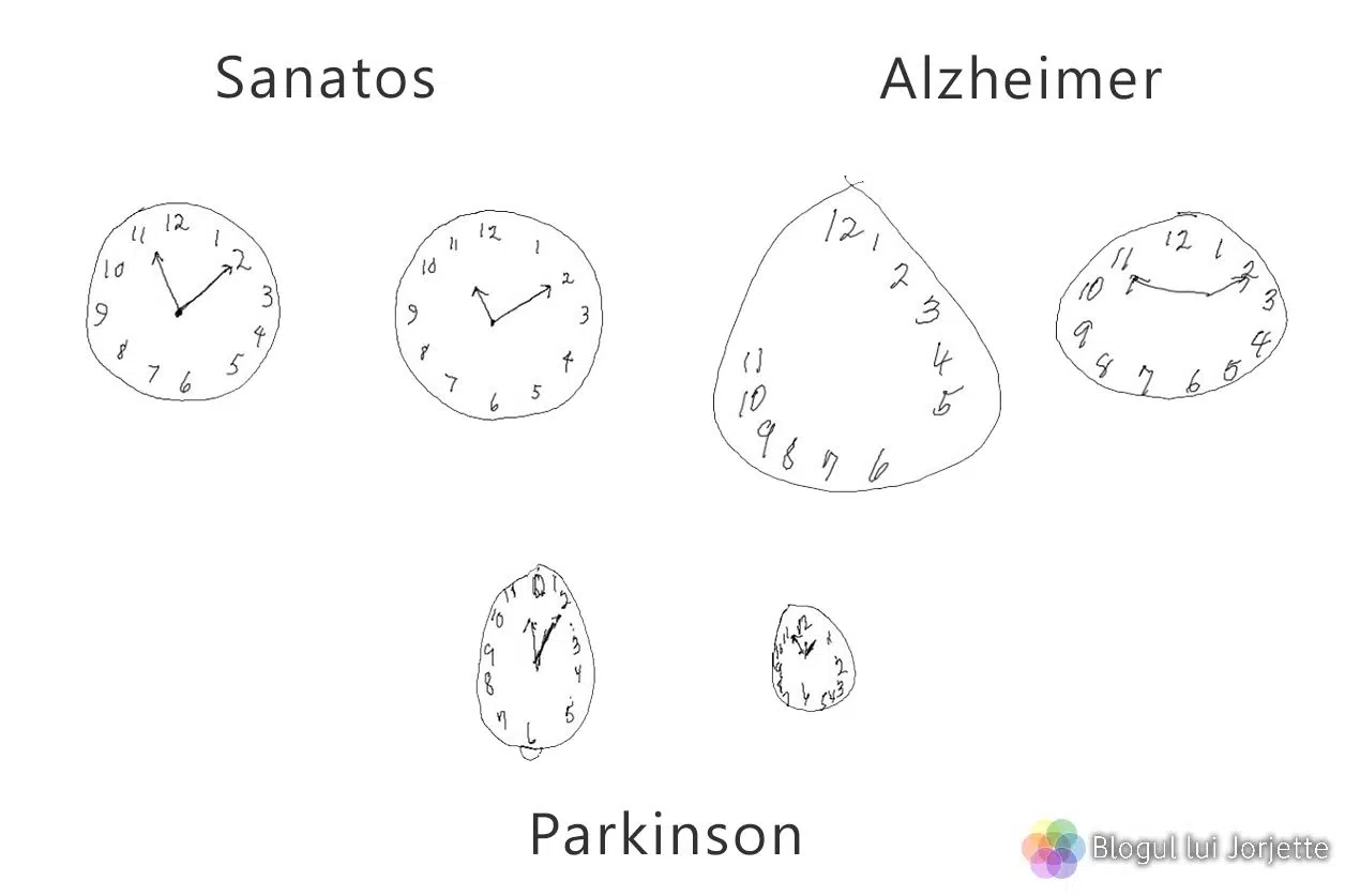 Test pentru Alzheimer - Desenul ceasului